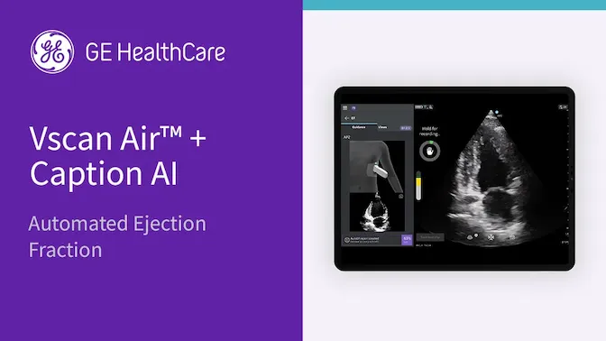 Caption ai automated ejection fraction 7nAxEyMy