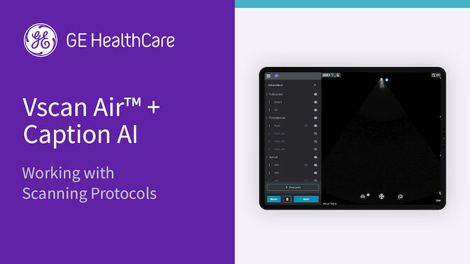 Caption ai working with scanning protocols NA0GaYF5