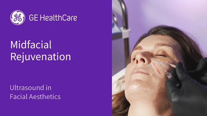 Midfacial rejuvenation Nz6O8JLh