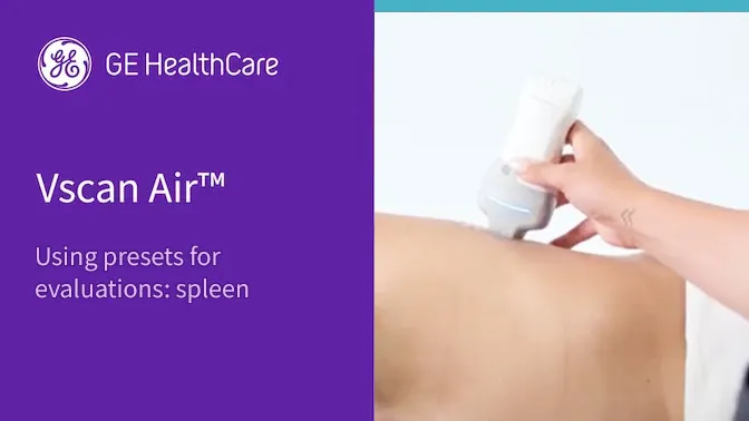 Using presets for evaluations spleen cSwiFg3a