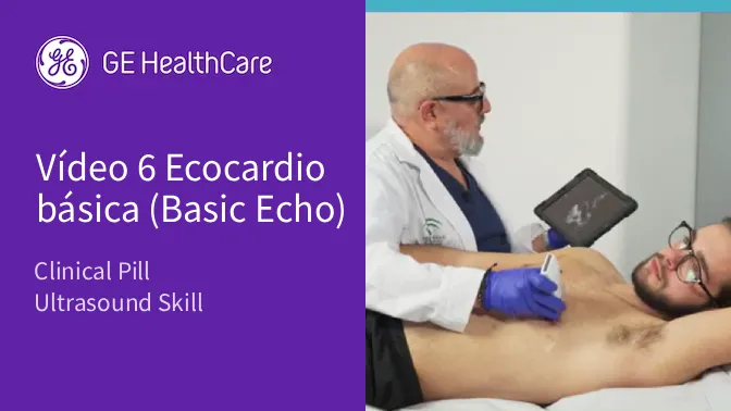 Video6ecocardio s04MkQLP