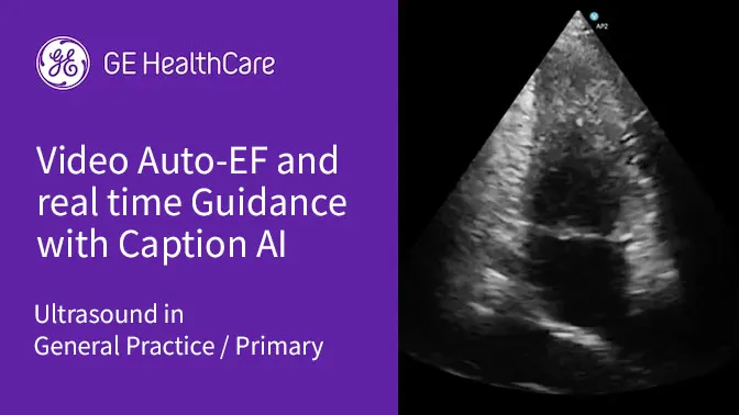 How Auto-EF & real time guidance with Caption AI can detect early heart disease