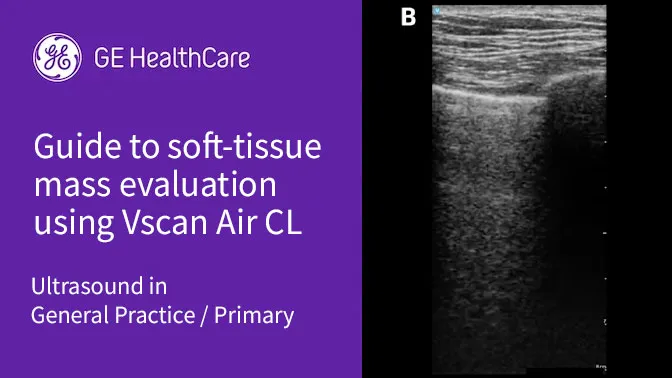 Webinars vscan soft tissue q5OgjNNJ