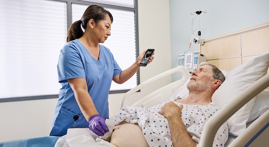 Nurse patient experience